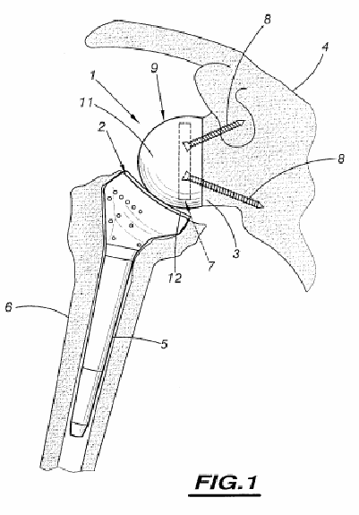 Figure on page 5 of the opinion