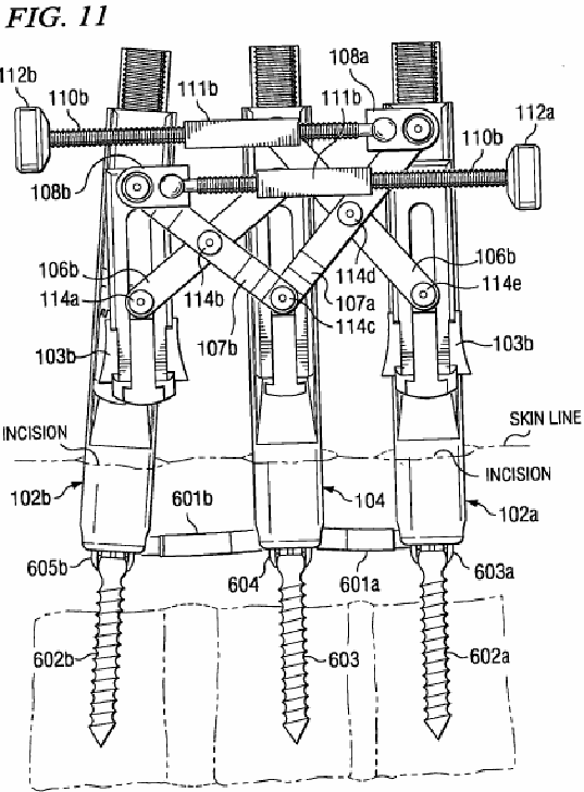 Figure on page 11 of the opinion