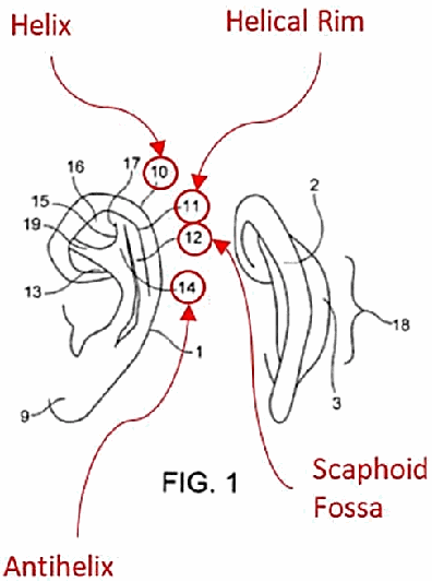 Figure on page 3 of the opinion