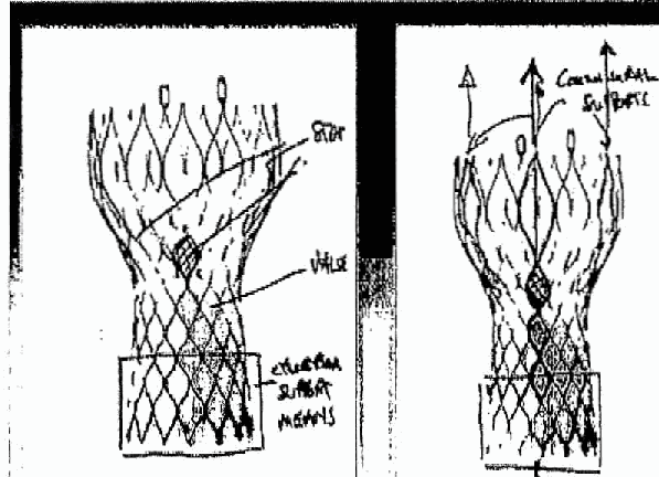 Figure on page 11 of the opinion