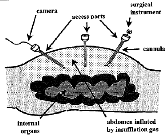 Figure on page 3 of the opinion