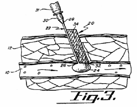 Figure on page 7 of the opinion
