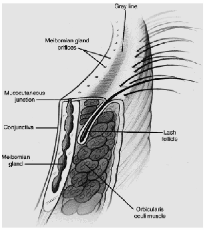 Figure on page 3 of the opinion