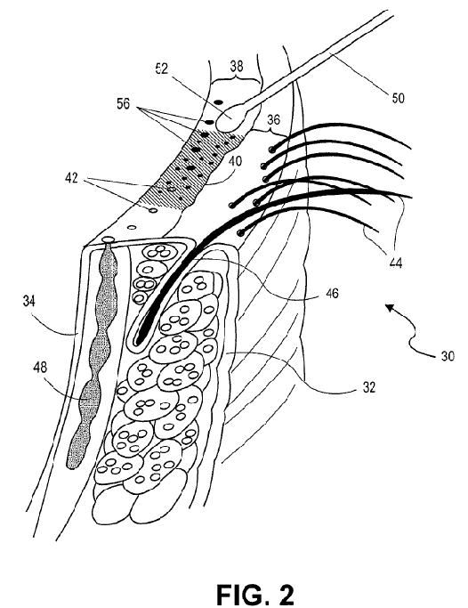 Figure on page 5 of the opinion