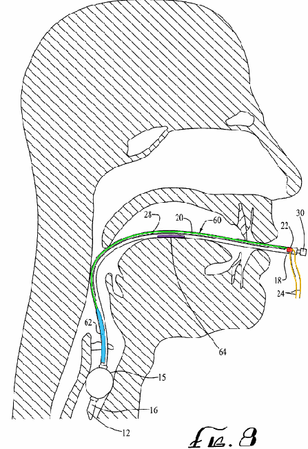 Figure on page 3 of the opinion